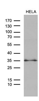 ZMAT4 Antibody (OTI9E11) Western Blot;ZMAT4 Antibody (OTI9E11)[NBP3-44810]-