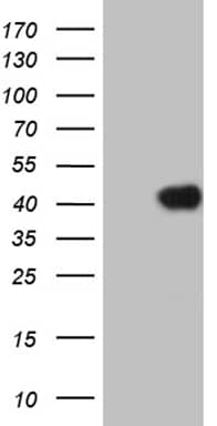 HOXC4 Antibody (OTI6B11) Western Blot;HOXC4 Antibody (OTI6B11)[NBP3-44811]-