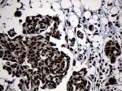 HOXC4 Antibody (OTI2D5) Immunohistochemistry;HOXC4 Antibody (OTI2D5)[NBP3-44812]-