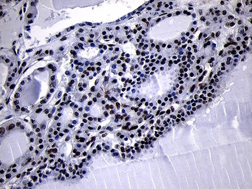 HOXC4 Antibody (OTI2D5) Immunohistochemistry;HOXC4 Antibody (OTI2D5)[NBP3-44812]-