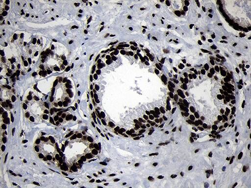 HOXC4 Antibody (OTI2D5) Immunohistochemistry;HOXC4 Antibody (OTI2D5)[NBP3-44812]-