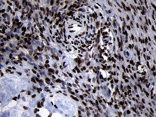 HOXC4 Antibody (OTI2D5) Immunohistochemistry;HOXC4 Antibody (OTI2D5)[NBP3-44812]-
