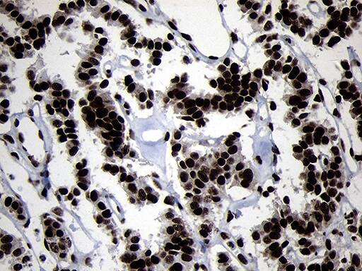 HOXC4 Antibody (OTI2D5) Immunohistochemistry;HOXC4 Antibody (OTI2D5)[NBP3-44812]-