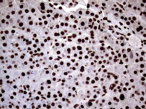SH3BGRL Antibody (OTI8F7) Immunohistochemistry;SH3BGRL Antibody (OTI8F7)[NBP3-44815]-