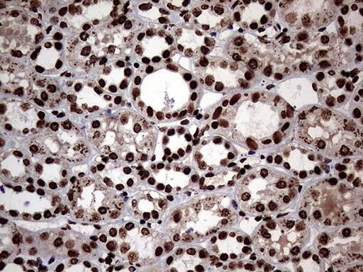 SH3BGRL Antibody (OTI8F7) Immunohistochemistry;SH3BGRL Antibody (OTI8F7)[NBP3-44815]-