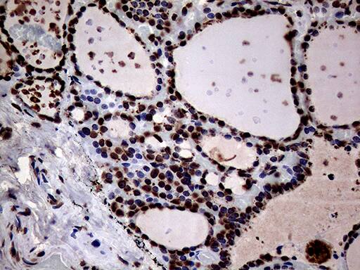 SH3BGRL Antibody (OTI8F7) Immunohistochemistry;SH3BGRL Antibody (OTI8F7)[NBP3-44815]-