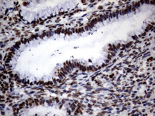 SH3BGRL Antibody (OTI8F7) Immunohistochemistry;SH3BGRL Antibody (OTI8F7)[NBP3-44815]-