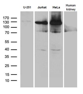 SUPT16H Antibody (OTI3B8) Western Blot;SUPT16H Antibody (OTI3B8)[NBP3-44820]-