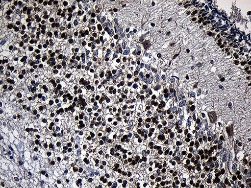 PHF20L1 Antibody (OTI1H6) Immunohistochemistry;PHF20L1 Antibody (OTI1H6)[NBP3-44822]-