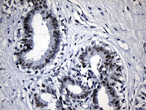 SUPT16H Antibody (OTI8A1) Immunohistochemistry;SUPT16H Antibody (OTI8A1)[NBP3-44829]-