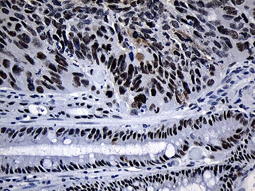 SUPT16H Antibody (OTI8A1) Immunohistochemistry;SUPT16H Antibody (OTI8A1)[NBP3-44829]-