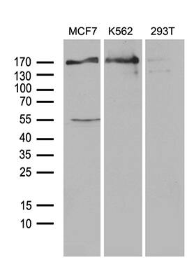 USP40 Antibody (OTI2C5) Western Blot;USP40 Antibody (OTI2C5)[NBP3-44832]-