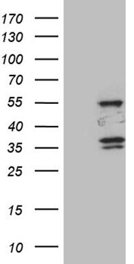 SPAG4 Antibody (OTI3E9) Western Blot;SPAG4 Antibody (OTI3E9)[NBP3-44837]-