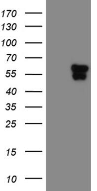 TEKT2 Antibody (OTI1E11) Western Blot;TEKT2 Antibody (OTI1E11)[NBP3-44849]-