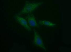 Tyrosine Hydroxylase Antibody (OTI3G3) Immunocytochemistry/ Immunofluorescence;Tyrosine Hydroxylase Antibody (OTI3G3)[NBP3-44861]-