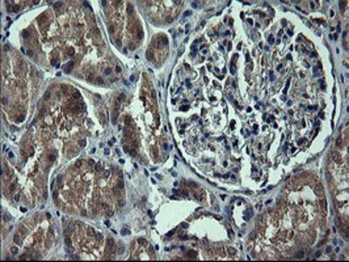 Tyrosine Hydroxylase Antibody (OTI3G3) Immunohistochemistry;Tyrosine Hydroxylase Antibody (OTI3G3)[NBP3-44861]-
