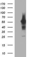 Tyrosine Hydroxylase Antibody (OTI3G3) Western Blot;Tyrosine Hydroxylase Antibody (OTI3G3)[NBP3-44861]-