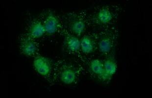 Tyrosine Hydroxylase Antibody (OTI2D4)