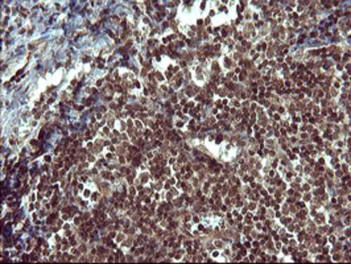 Tyrosine Hydroxylase Antibody (OTI2D4)