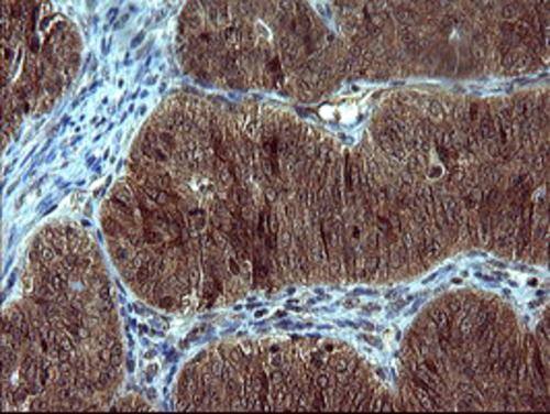 Tyrosine Hydroxylase Antibody (OTI2D4)
