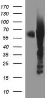 Tyrosine Hydroxylase Antibody (OTI2D4)