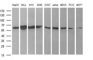 Tyrosine Hydroxylase Antibody (OTI2D4) Western Blot;Tyrosine Hydroxylase Antibody (OTI2D4)[NBP3-44862]-
