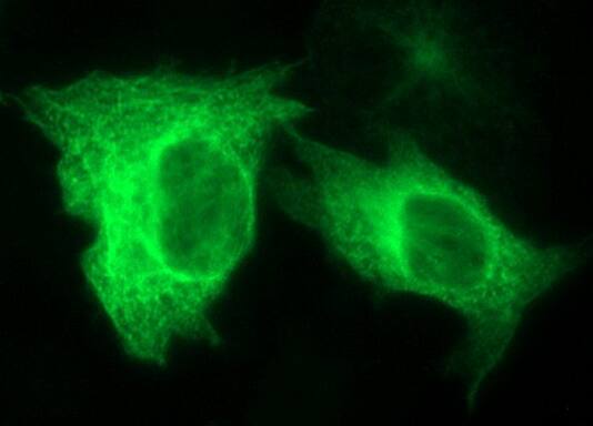 beta II Tubulin Antibody (OTI3B7)