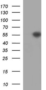 beta II Tubulin Antibody (OTI3B7)