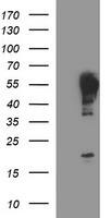 beta II Tubulin Antibody (OTI1H3)