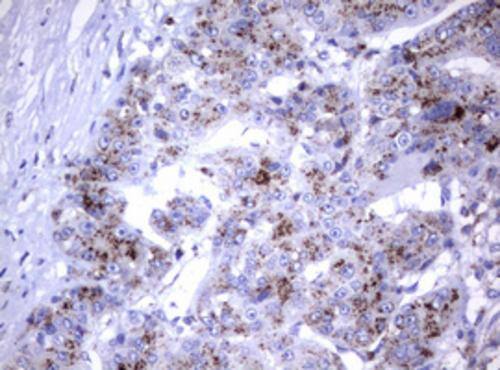 NEU-1/Sialidase-1 Antibody (OTI3B3) Immunohistochemistry;NEU-1/Sialidase-1 Antibody (OTI3B3)[NBP3-44875]-