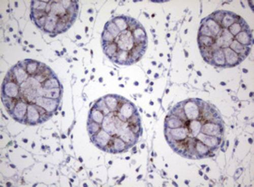 NEU-1/Sialidase-1 Antibody (OTI3B3) Immunohistochemistry;NEU-1/Sialidase-1 Antibody (OTI3B3)[NBP3-44875]-