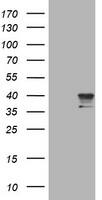 NEU-1/Sialidase-1 Antibody (OTI3F5) Western Blot;NEU-1/Sialidase-1 Antibody (OTI3F5)[NBP3-44880]-