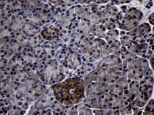 USP40 Antibody (OTI2C5) Immunohistochemistry;USP40 Antibody (OTI2C5)[NBP3-44885]-