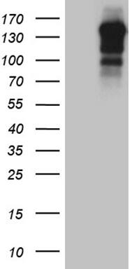 USP40 Antibody (OTI2C5) Western Blot;USP40 Antibody (OTI2C5)[NBP3-44885]-