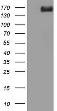 DCC Antibody (OTI4A1) Western Blot;DCC Antibody (OTI4A1)[NBP3-44888]-