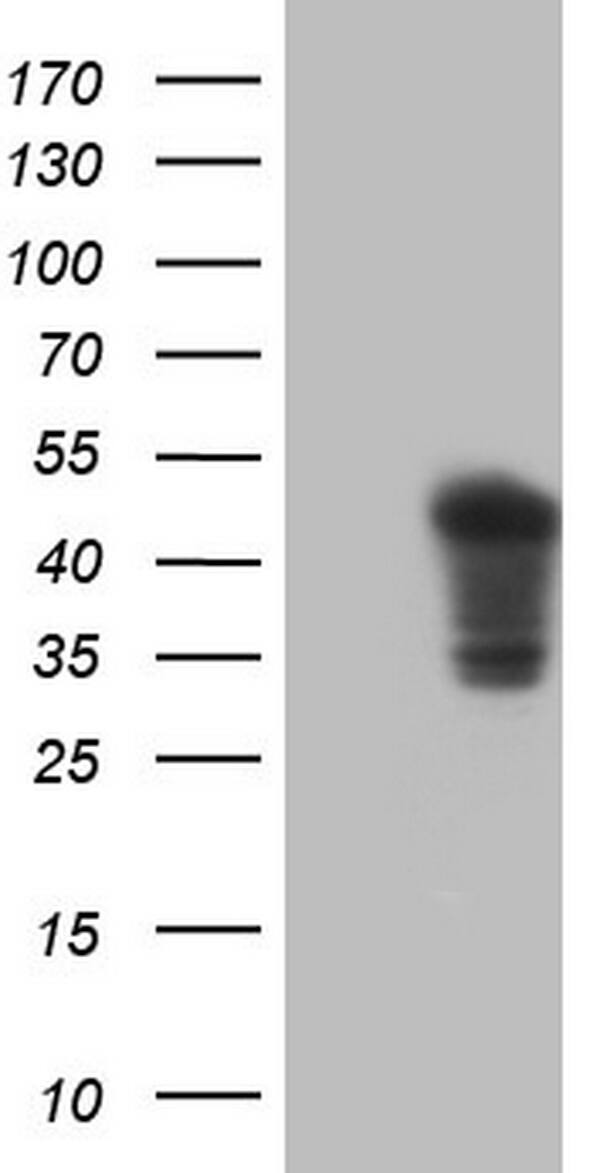 Cardiac Troponin T Antibody (OTI1G9) Western Blot;Cardiac Troponin T Antibody (OTI1G9)[NBP3-44890]-