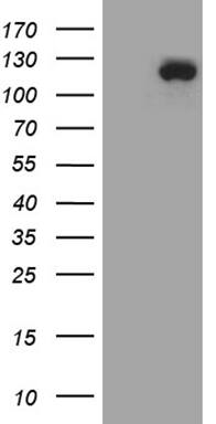 UBE3B Antibody (OTI4E4) Western Blot;UBE3B Antibody (OTI4E4)[NBP3-44891]-