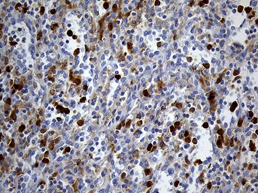 UBE3B Antibody (OTI3F10) Immunohistochemistry;UBE3B Antibody (OTI3F10)[NBP3-44892]-