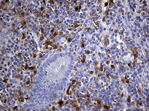 UBE3B Antibody (OTI3F10) Immunohistochemistry;UBE3B Antibody (OTI3F10)[NBP3-44892]-