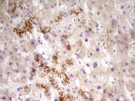 PAPSS2 Antibody (OTI3H10)