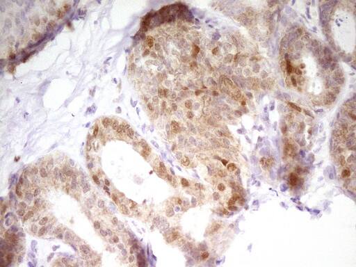 PAPSS2 Antibody (OTI3H10) Immunohistochemistry;PAPSS2 Antibody (OTI3H10)[NBP3-44893]-