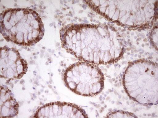 PAPSS2 Antibody (OTI3H10) Immunohistochemistry;PAPSS2 Antibody (OTI3H10)[NBP3-44893]-