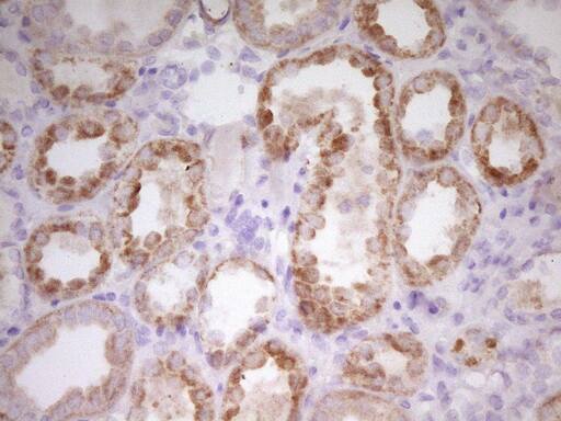 PAPSS2 Antibody (OTI3H10) Immunohistochemistry;PAPSS2 Antibody (OTI3H10)[NBP3-44893]-