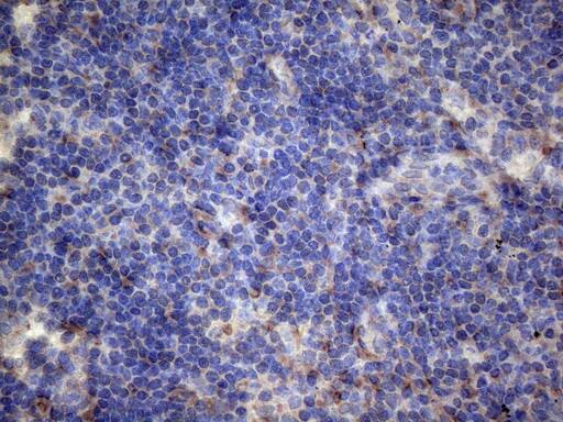 PAPSS2 Antibody (OTI6H10) Immunohistochemistry;PAPSS2 Antibody (OTI6H10)[NBP3-44898]-