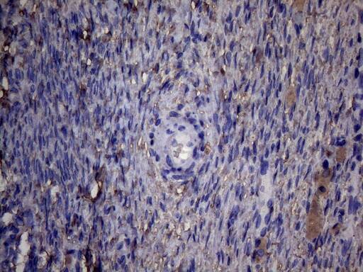 PAPSS2 Antibody (OTI6H10) Immunohistochemistry;PAPSS2 Antibody (OTI6H10)[NBP3-44898]-