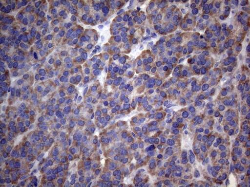 PAPSS2 Antibody (OTI6H10) Immunohistochemistry;PAPSS2 Antibody (OTI6H10)[NBP3-44898]-