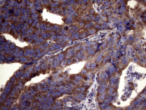 PAPSS2 Antibody (OTI6H10) Immunohistochemistry;PAPSS2 Antibody (OTI6H10)[NBP3-44898]-