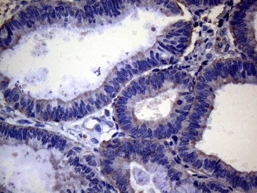 PAPSS2 Antibody (OTI6H10) Immunohistochemistry;PAPSS2 Antibody (OTI6H10)[NBP3-44898]-
