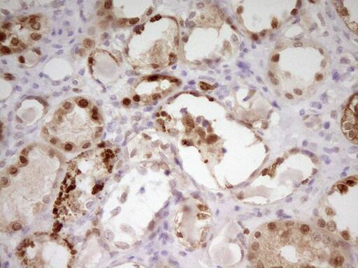 PAPSS2 Antibody (OTI2E7)