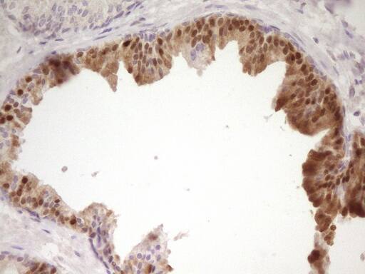 PAPSS2 Antibody (OTI2E7)
